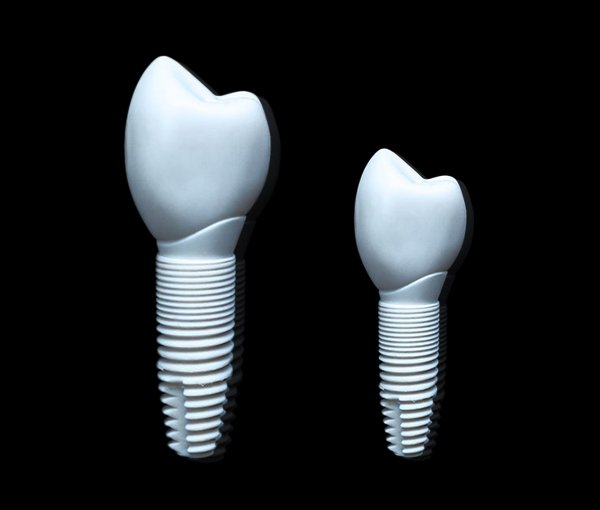 Zirconia dental implant placed in the jaw